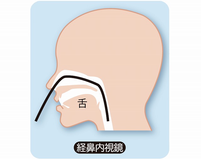 経鼻内視鏡検査（経鼻胃カメラ検査）